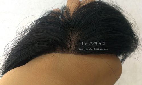 假发 毛囊搭配,技巧,价格